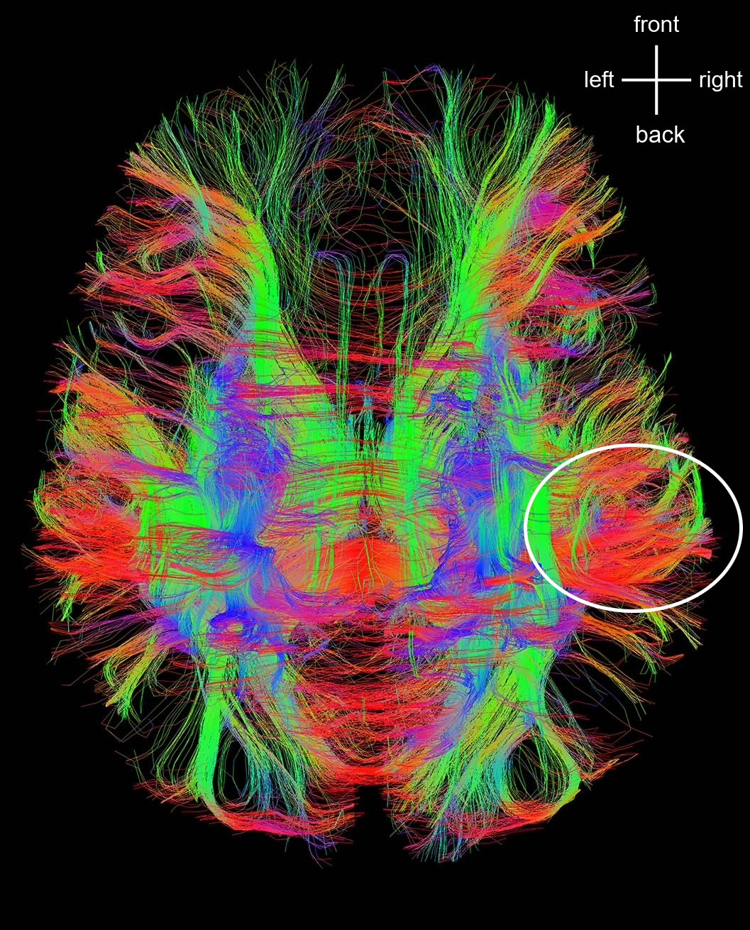 Human Brain Fiber Bundles