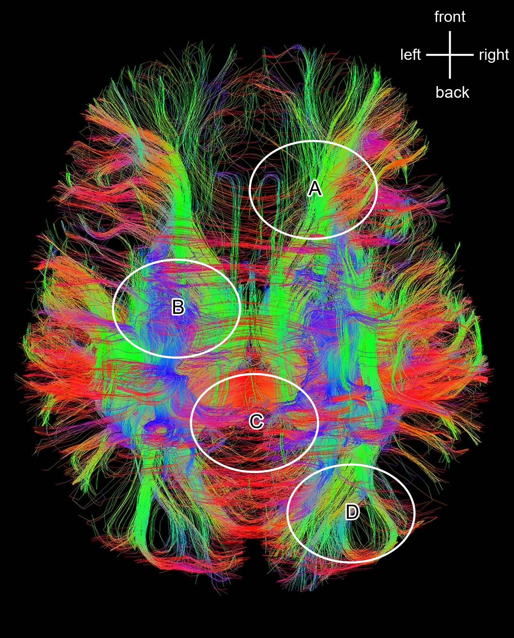 Human Brain Fiber Bundles